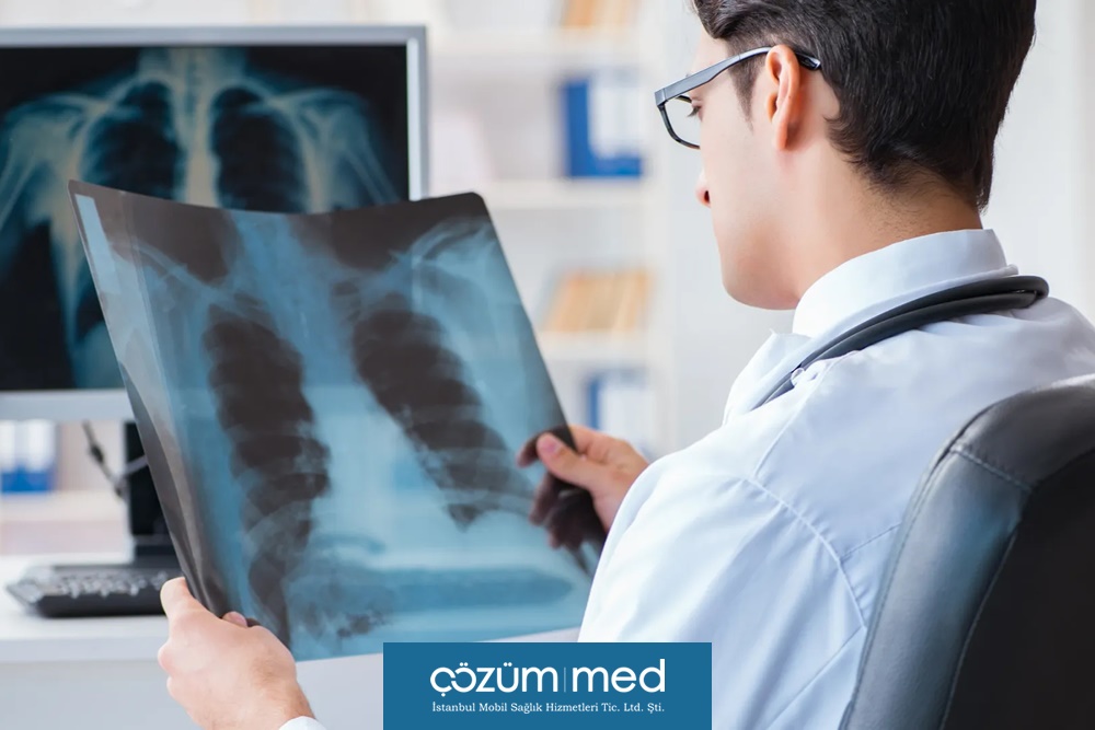 Akciğer Grafisi ile Önlenebilen Hastalıklar, Hangi Mesleklerde Risk Daha Yüksek?